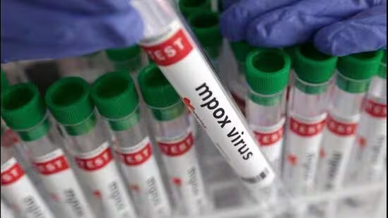 Mpox RT-PCR Kit: MPox टेस्ट के लिए बनाई गयी स्वदेशी RT-PCR किट जो 40 मिनट में बताएगी रिजल्ट